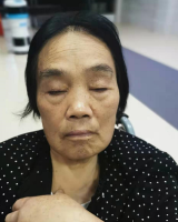 [女]约1944年出生2020年湖南省长沙市救助赵丁翠找家2203311354*