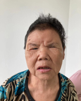 [女]约1954年出生14年河南省平顶山救助聋哑李湾找家2408271825*