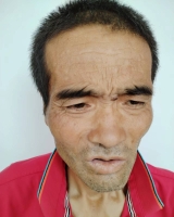 [男]约1958年出生2023年河南省西峡县救助无名氏找家2509131231*