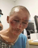 [男]约1952年出生2021年四川省南充市救助无名氏找家2109152232